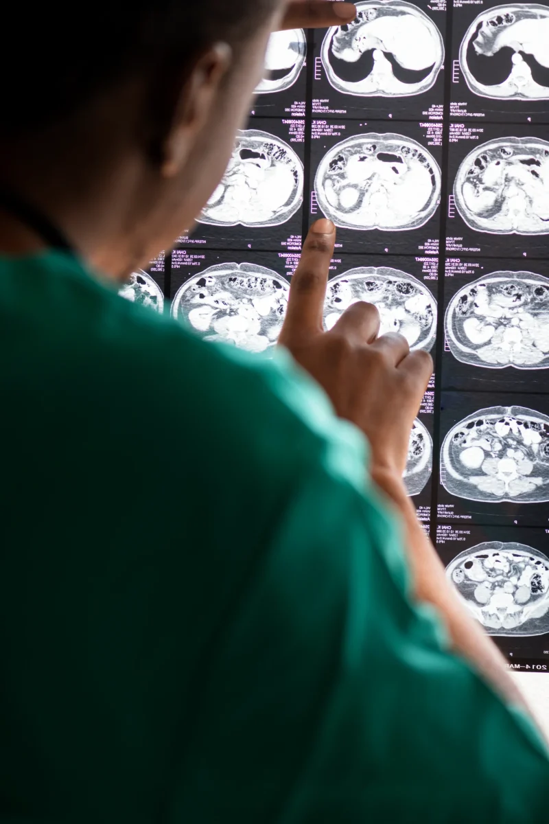 doctor-reading-brain-mri-x-ray-result